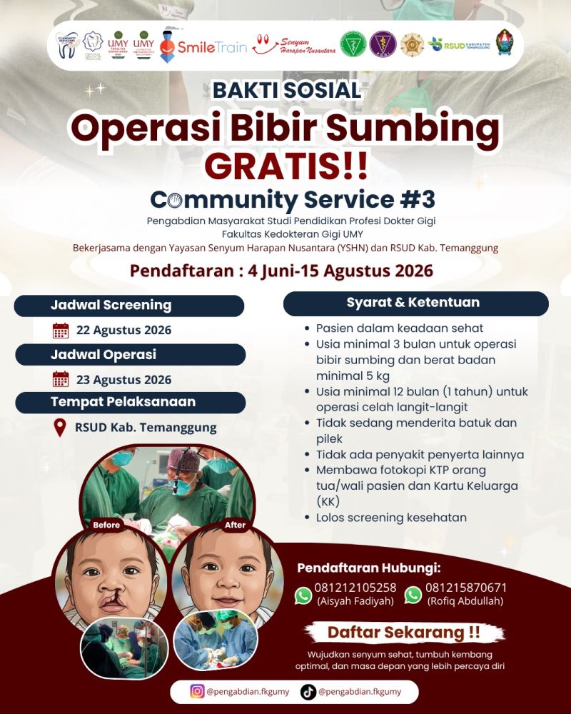 Bakti Sosial Operasi Bibir Sumbing Gratis